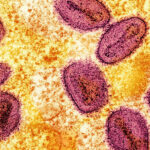 Variante da mpox é detectada na Alemanha - 22/10/2024 - Equilíbrio e Saúde