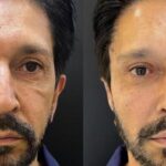 Tales: Harmonização de Nunes tem que ser investigada: 'Presente caro'