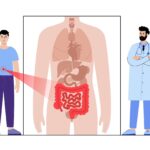 Mitos sobre saúde intestinal: veja o que dizem médicos - 29/01/2025 - Equilíbrio