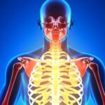 Pessoas com fibromialgia sentem dor no corpo todo