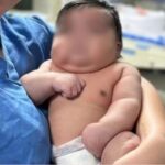 Mãe leva 50 pontos após parto normal de bebê de 6,5 quilos