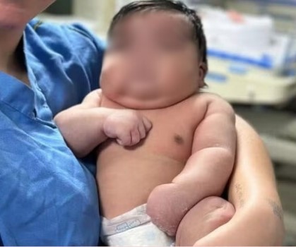 Mãe leva 50 pontos após parto normal de bebê de 6,5 quilos