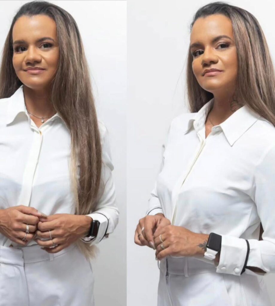 Juliana Garcia reaparece nas redes e emociona o país após cirurgia reconstructiva bem-sucedida