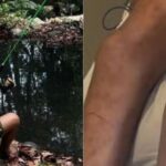 João Pedro morreu em decorrências das picadas de abelhas