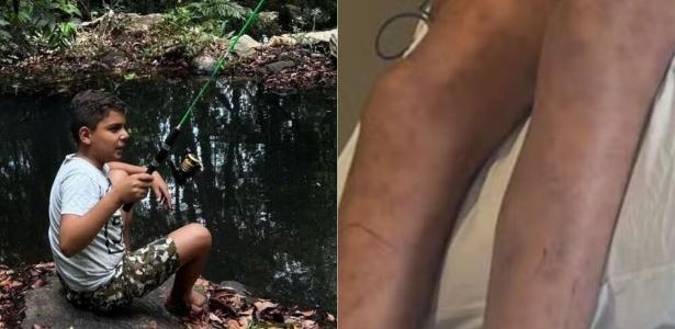 João Pedro morreu em decorrências das picadas de abelhas