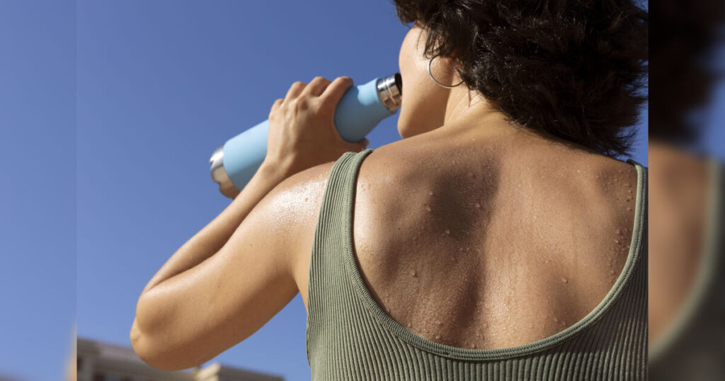 Calor pode aumentar risco de casos de AVC, alerta médico