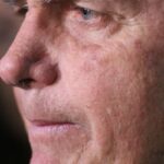 Com crise persistente de soluços, Bolsonaro faz nova cirurgia