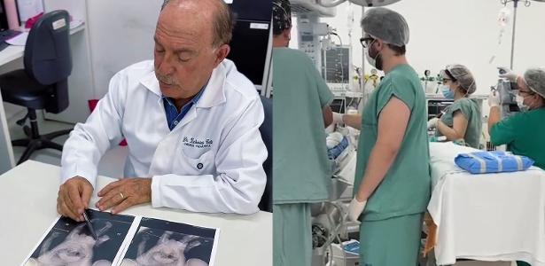 Siameses nasceram na terça-feira em Goiânia e um deles teve a morte constatada hoje, segundo o médico Zacharias Calil