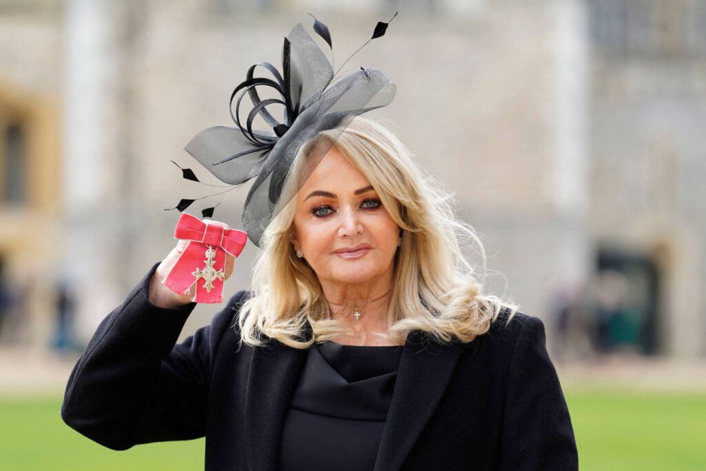 Bonnie Tyler se recupera após internação de emergência - 07/05/2026 - Ilustrada
